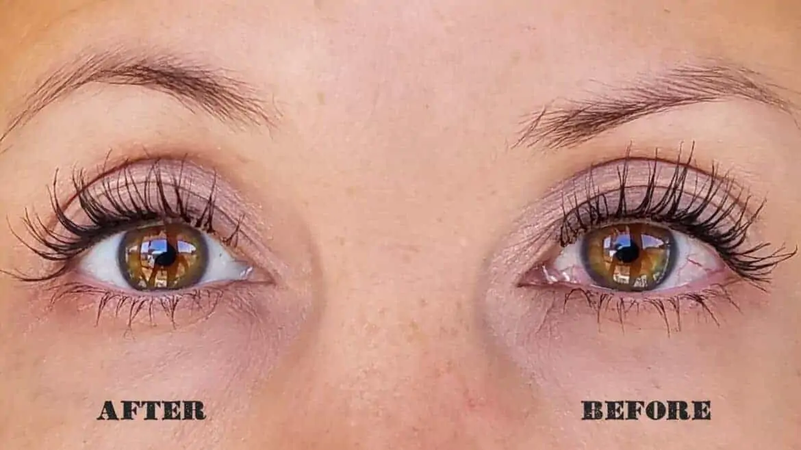 Rohto Dry-Aid before and after