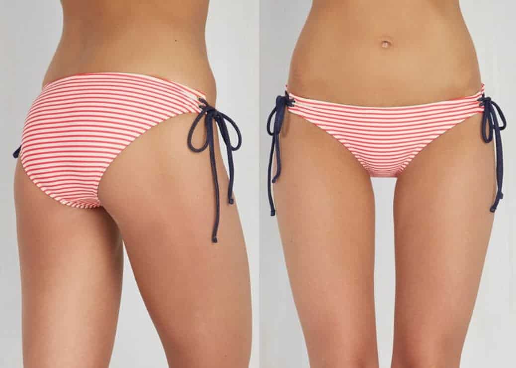 How to Choose the Correct Swimsuit for Your Body Type